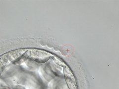 泰国试管婴儿技术哪代强?