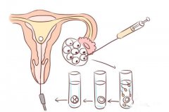 试管婴儿促排前，女性应该如何调理？